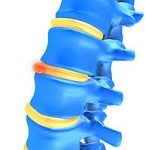 correct spine